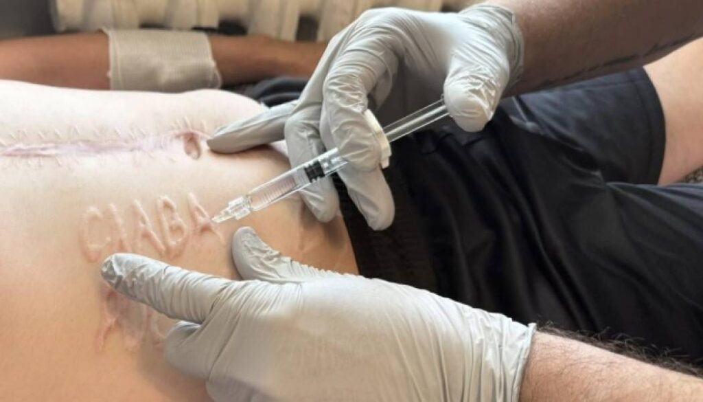 Лікарі почали лікувати шрами на тілі солдата, на якому під час перебування в полоні випалювали напис «Слава Росії» 12 Лікарі почали лікувати шрами на тілі солдата, на якому під час перебування в полоні випалювали напис «Слава Росії» 12