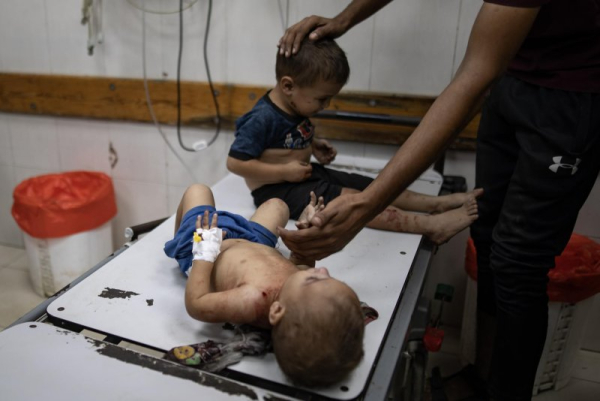 Wounded children receive treatment at Nasser Hospital in Khan Younis, following an Israeli strike on a tent sheltering displaced persons in Khan Younis, southern Gaza Strip, on Sunday. Photo by Haitham Imad/EPA