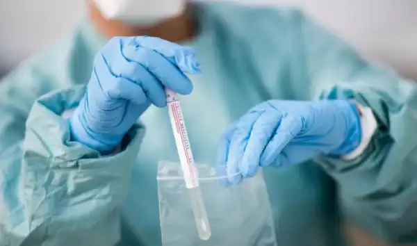 Виявлено перше зараження штамом COVID-19 “Цикада” в Україні