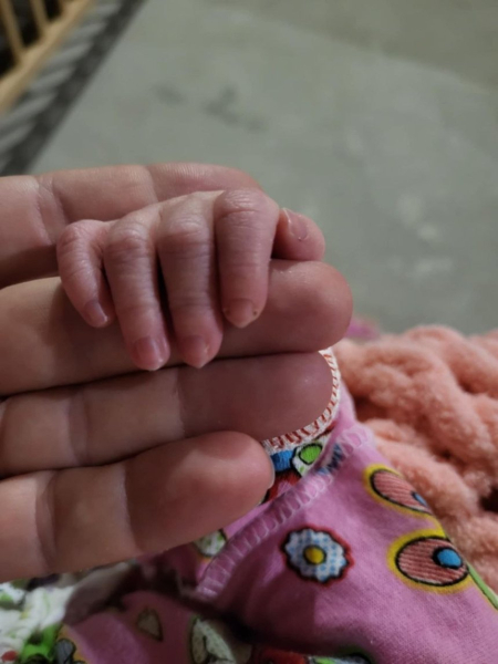 Рука донечки. Фото надані героїнею Спогади киян про 24 лютого